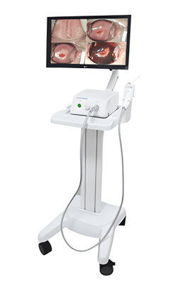Video Colposcope - Dr Camscope Pro LED Digital Video Colposcope DSC-102Pro