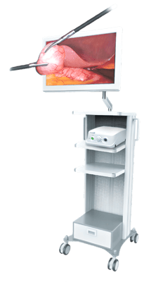 Endoscopic Camera System DSC-103E Pro for Laparoscopy & Endososcopy