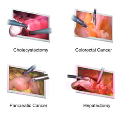 Endoscopic Camera System DSC-103E Pro for Laparoscopy & Endososcopy