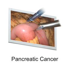 Endoscopic Camera System DSC-103E Pro for Laparoscopy & Endososcopy