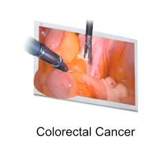 Endoscopic Camera System DSC-103E Pro for Laparoscopy & Endososcopy