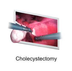 Endoscopic Camera System DSC-103E Pro for Laparoscopy & Endososcopy