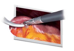 Endoscopic Camera System DSC-103E Pro for Laparoscopy & Endososcopy