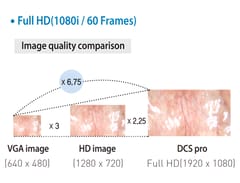 Endoscopic Camera System DSC-103E Pro for Laparoscopy & Endososcopy