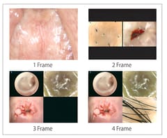 Endoscopic Camera System DSC-103E Pro for Laparoscopy & Endososcopy