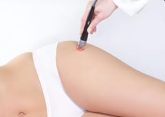 Pain Management Laser Handpiece Compatible with Lasotronix Laser